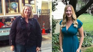 keto ultra weight loss before and after